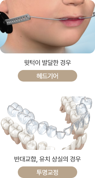 헤드기어
