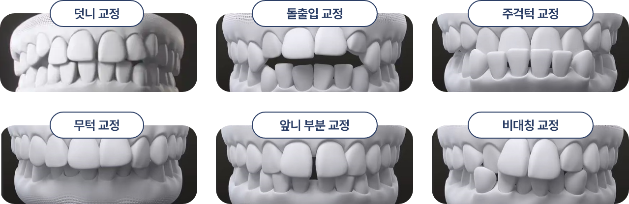 증상별 교정