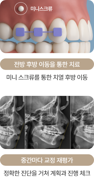 전방 후방 이동을 통한 치료