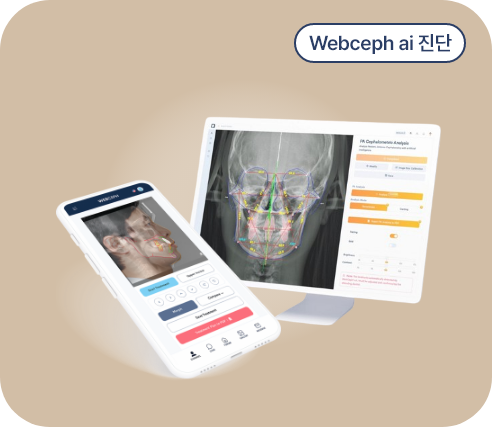 Webceph ai 진단
